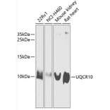 Western Blot - Anti-Cytochrome b-c1 complex subunit 9/UQCR10 Antibody (A87823) - Antibodies.com