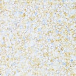 Immunohistochemistry - Anti-Cytochrome b-c1 complex subunit 9/UQCR10 Antibody (A87823) - Antibodies.com