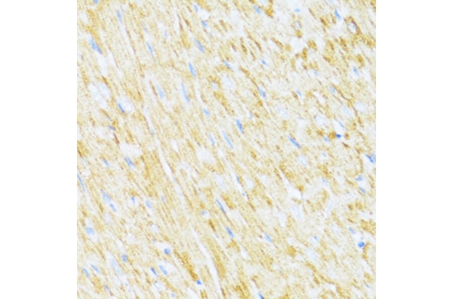 Immunohistochemistry - Anti-Cytochrome b-c1 complex subunit 9/UQCR10 Antibody (A87823) - Antibodies.com