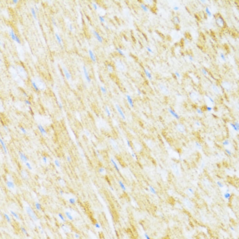 Immunohistochemistry - Anti-Cytochrome b-c1 complex subunit 9/UQCR10 Antibody (A87823) - Antibodies.com