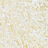 Immunohistochemistry - Anti-Cytochrome b-c1 complex subunit 9/UQCR10 Antibody (A87823) - Antibodies.com