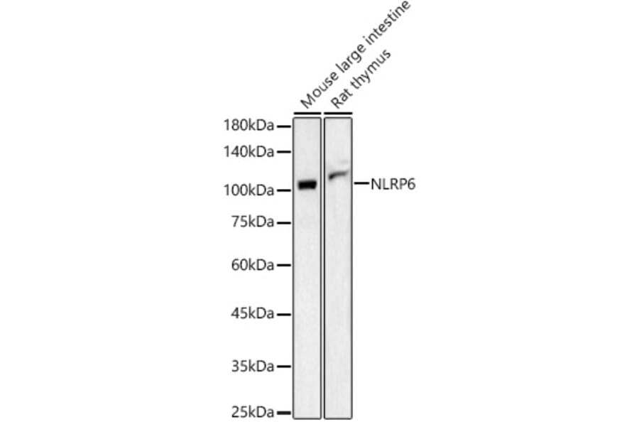 Western Blot - Anti-NLRP6 Antibody (A87824) - Antibodies.com