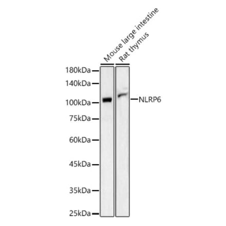 Western Blot - Anti-NLRP6 Antibody (A87824) - Antibodies.com
