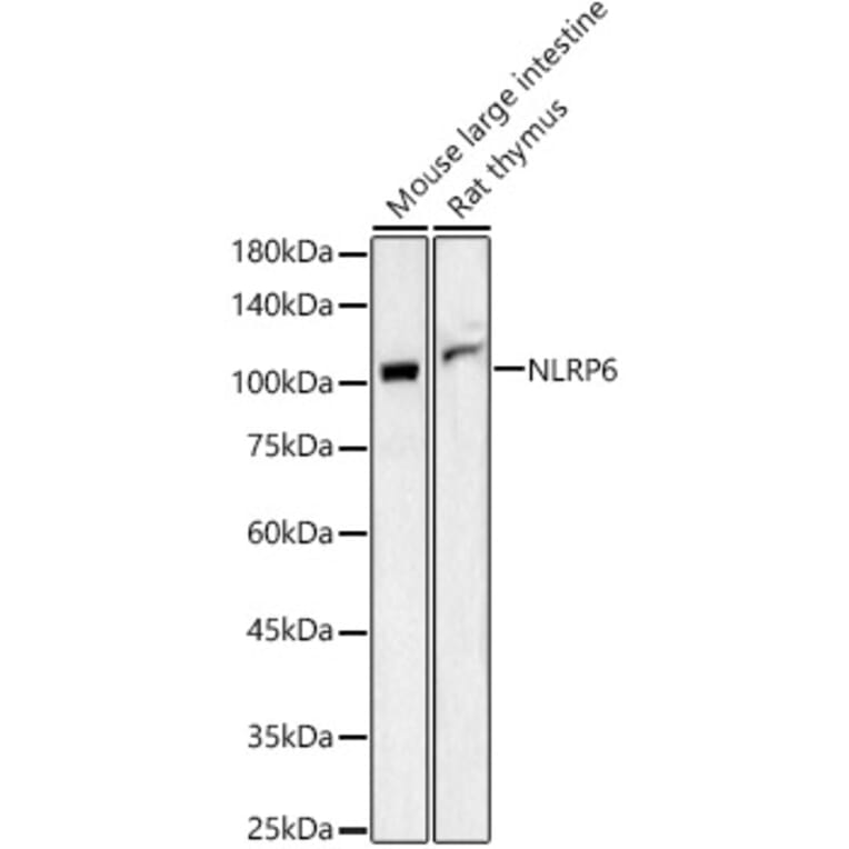 Western Blot - Anti-NLRP6 Antibody (A87824) - Antibodies.com