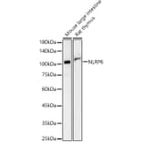 Western Blot - Anti-NLRP6 Antibody (A87824) - Antibodies.com