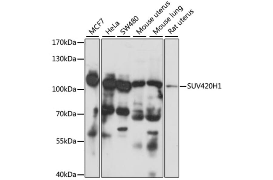 Western Blot - Anti-SUV420h1 Antibody (A87825) - Antibodies.com