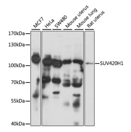 Western Blot - Anti-SUV420h1 Antibody (A87825) - Antibodies.com