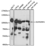 Western Blot - Anti-SUV420h1 Antibody (A87825) - Antibodies.com