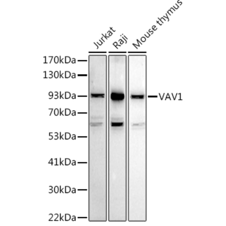 Western Blot - Anti-VAV1 Antibody (A87826) - Antibodies.com