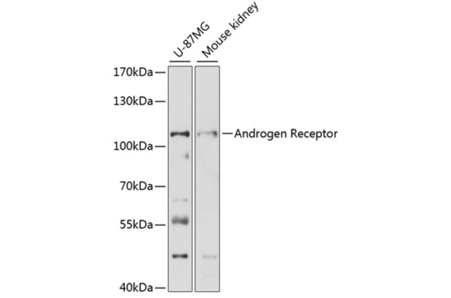 Western Blot - Anti-Androgen Receptor Antibody (A87827) - Antibodies.com