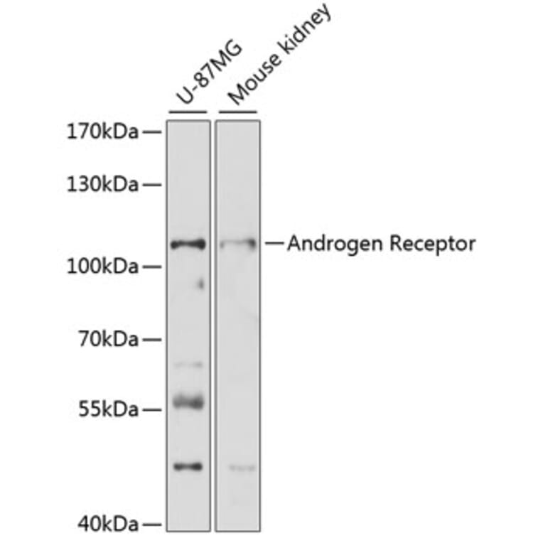 Western Blot - Anti-Androgen Receptor Antibody (A87827) - Antibodies.com