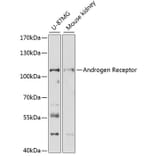 Western Blot - Anti-Androgen Receptor Antibody (A87827) - Antibodies.com