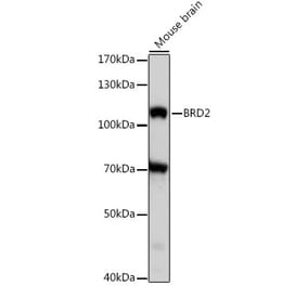 Western Blot - Anti-BRD2 Antibody (A87828) - Antibodies.com