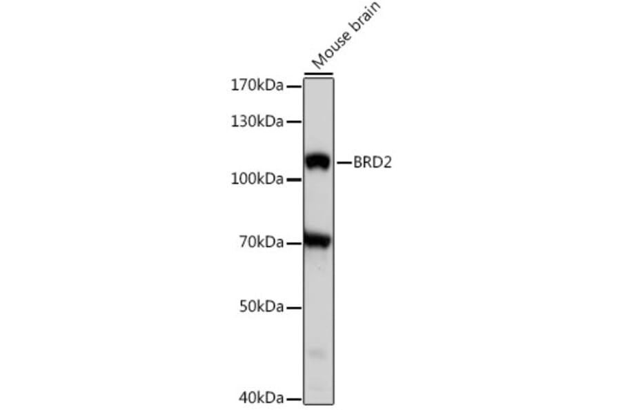 Western Blot - Anti-BRD2 Antibody (A87828) - Antibodies.com