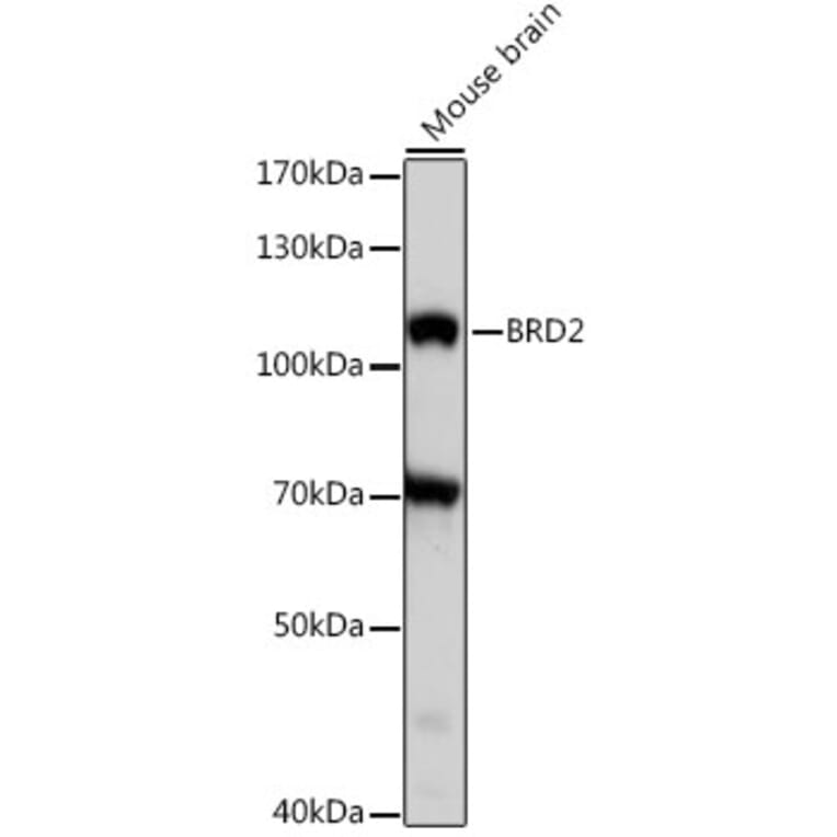 Western Blot - Anti-BRD2 Antibody (A87828) - Antibodies.com