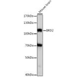 Western Blot - Anti-BRD2 Antibody (A87828) - Antibodies.com