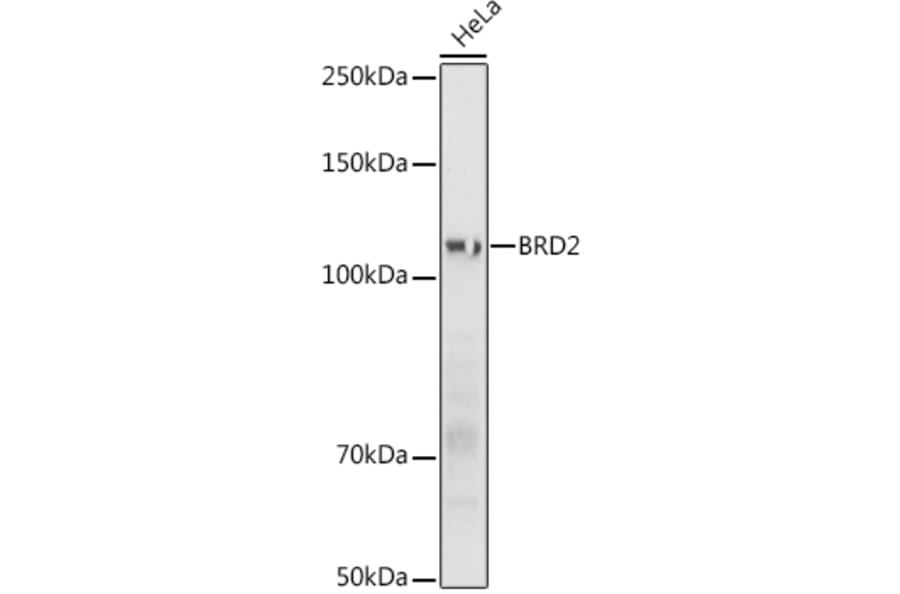Western Blot - Anti-BRD2 Antibody (A87828) - Antibodies.com