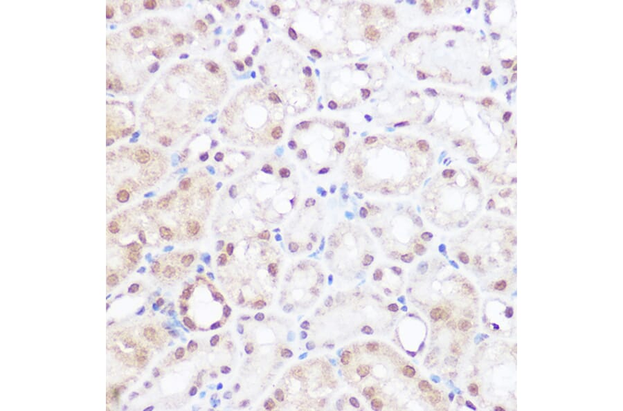 Immunohistochemistry - Anti-BRD2 Antibody (A87828) - Antibodies.com
