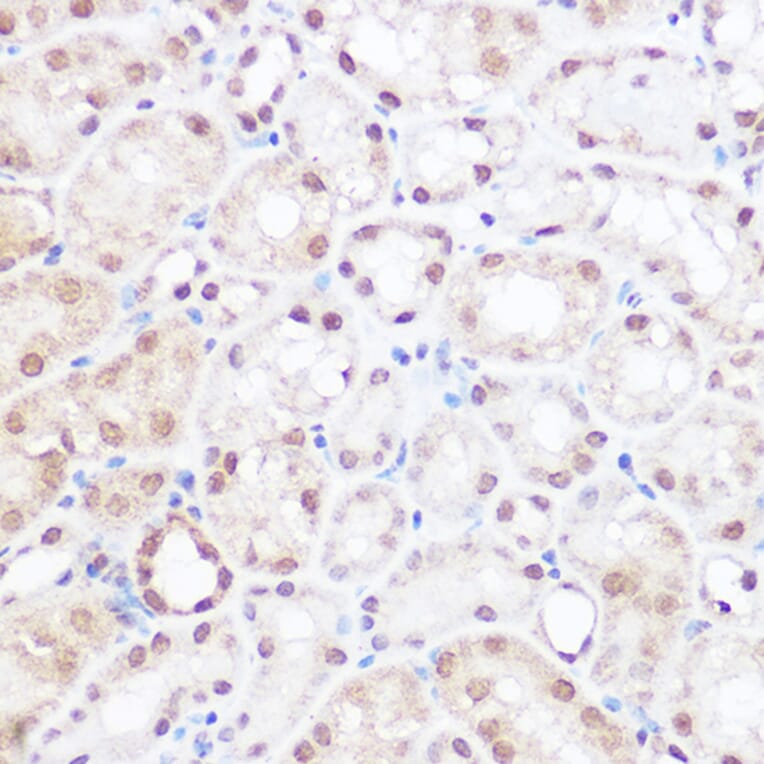 Immunohistochemistry - Anti-BRD2 Antibody (A87828) - Antibodies.com