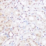 Immunohistochemistry - Anti-BRD2 Antibody (A87828) - Antibodies.com