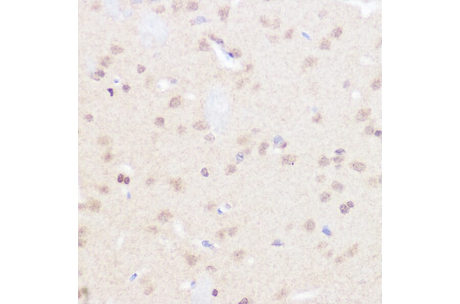 Immunohistochemistry - Anti-BRD2 Antibody (A87828) - Antibodies.com