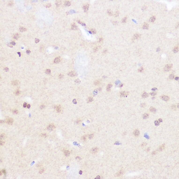 Immunohistochemistry - Anti-BRD2 Antibody (A87828) - Antibodies.com