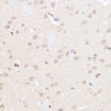 Immunohistochemistry - Anti-BRD2 Antibody (A87828) - Antibodies.com