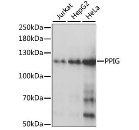 Western Blot - Anti-PPIG Antibody (A87829) - Antibodies.com