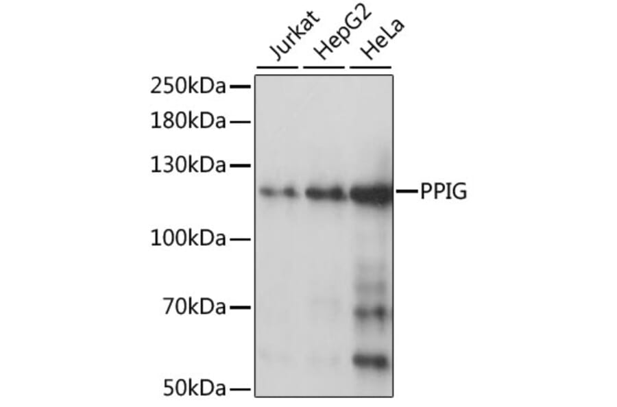 Western Blot - Anti-PPIG Antibody (A87829) - Antibodies.com