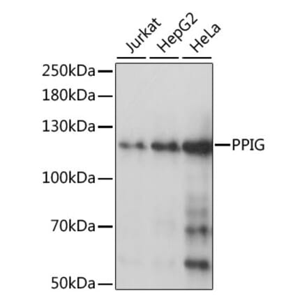 Western Blot - Anti-PPIG Antibody (A87829) - Antibodies.com