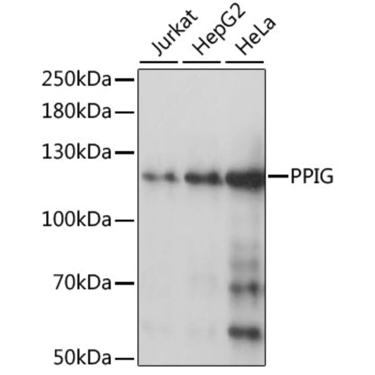 Western Blot - Anti-PPIG Antibody (A87829) - Antibodies.com