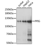 Western Blot - Anti-PPIG Antibody (A87829) - Antibodies.com