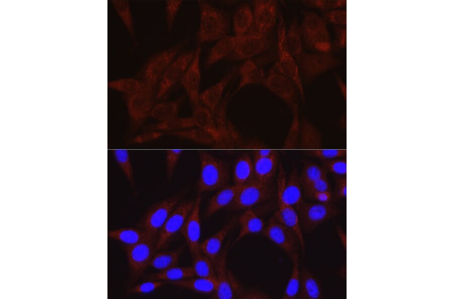 Immunofluorescence - Anti-VPS34 Antibody (A87830) - Antibodies.com