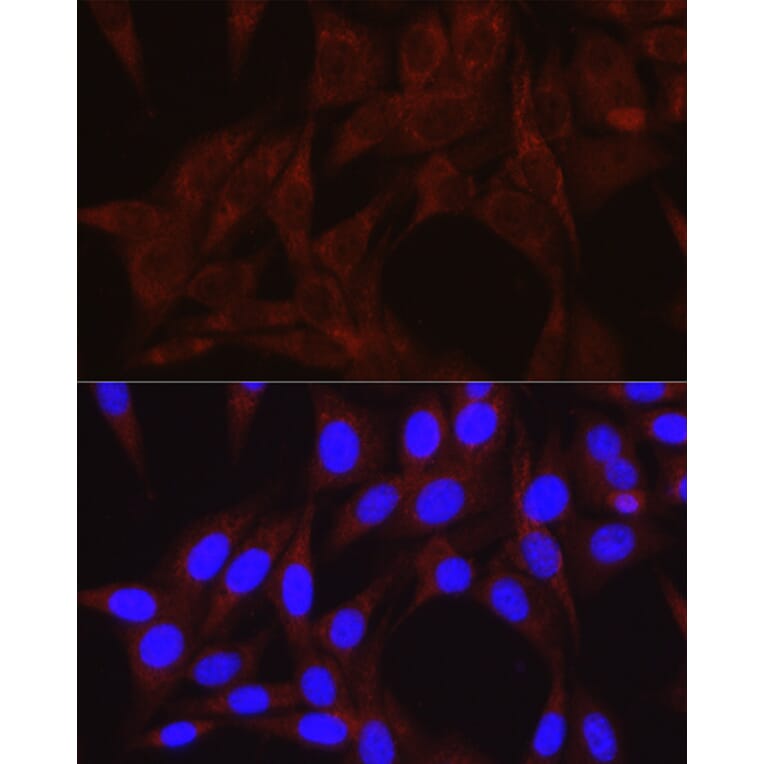 Immunofluorescence - Anti-VPS34 Antibody (A87830) - Antibodies.com