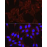 Immunofluorescence - Anti-VPS34 Antibody (A87830) - Antibodies.com