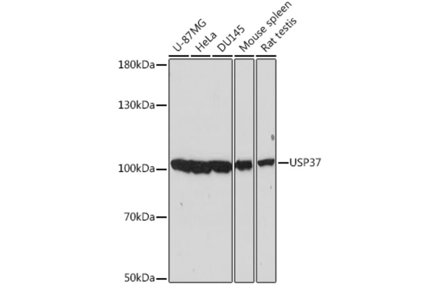 Western Blot - Anti-USP37 Antibody (A87831) - Antibodies.com