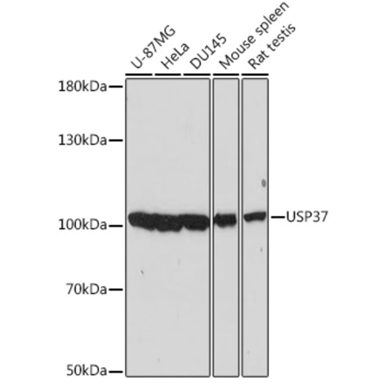 Western Blot - Anti-USP37 Antibody (A87831) - Antibodies.com