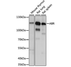 Western Blot - Anti-ABR Antibody (A87832) - Antibodies.com