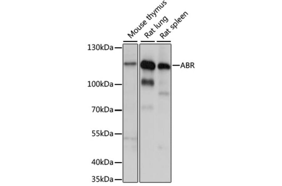 Western Blot - Anti-ABR Antibody (A87832) - Antibodies.com