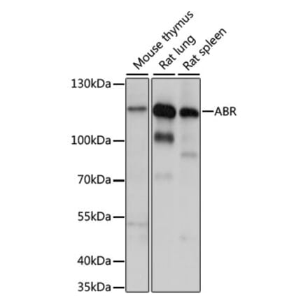 Western Blot - Anti-ABR Antibody (A87832) - Antibodies.com