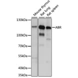 Western Blot - Anti-ABR Antibody (A87832) - Antibodies.com