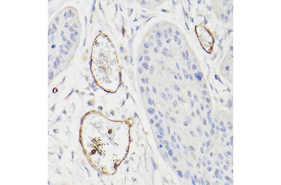 Immunohistochemistry - Anti-CD34 Antibody (A87833) - Antibodies.com