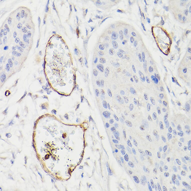 Immunohistochemistry - Anti-CD34 Antibody (A87833) - Antibodies.com