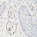 Immunohistochemistry - Anti-CD34 Antibody (A87833) - Antibodies.com