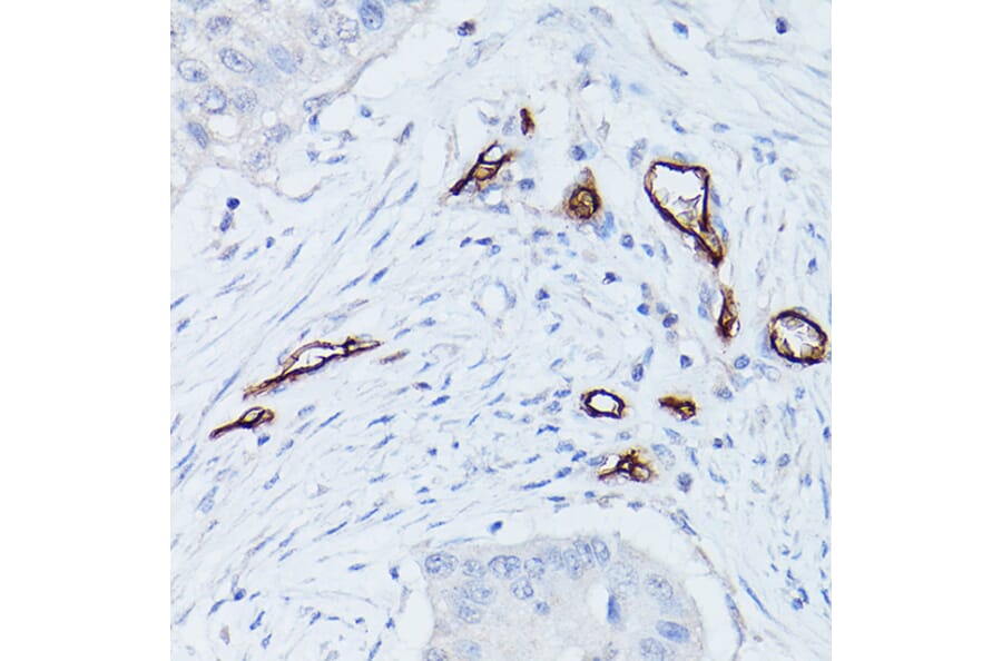 Immunohistochemistry - Anti-CD34 Antibody (A87833) - Antibodies.com