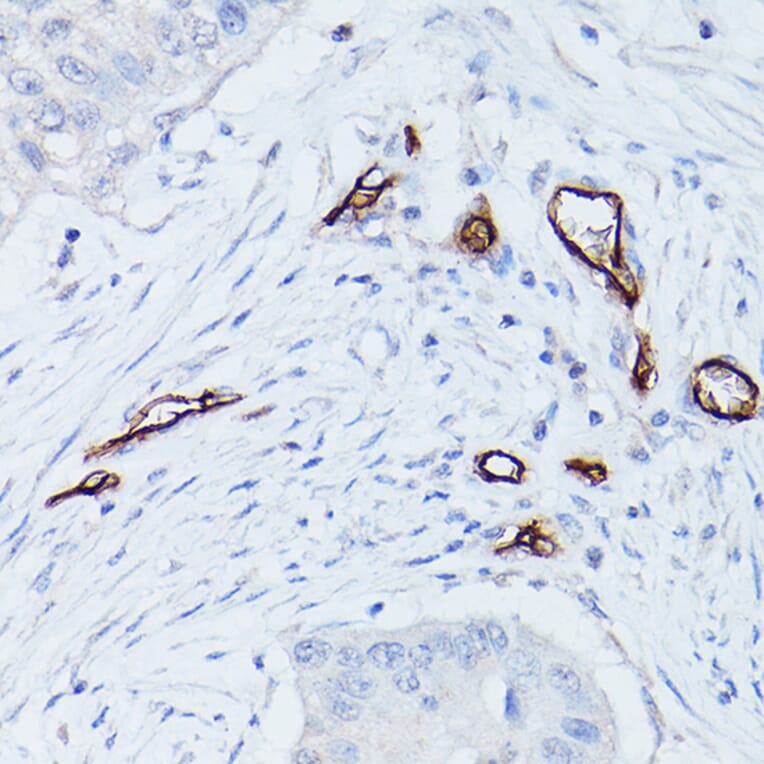 Immunohistochemistry - Anti-CD34 Antibody (A87833) - Antibodies.com