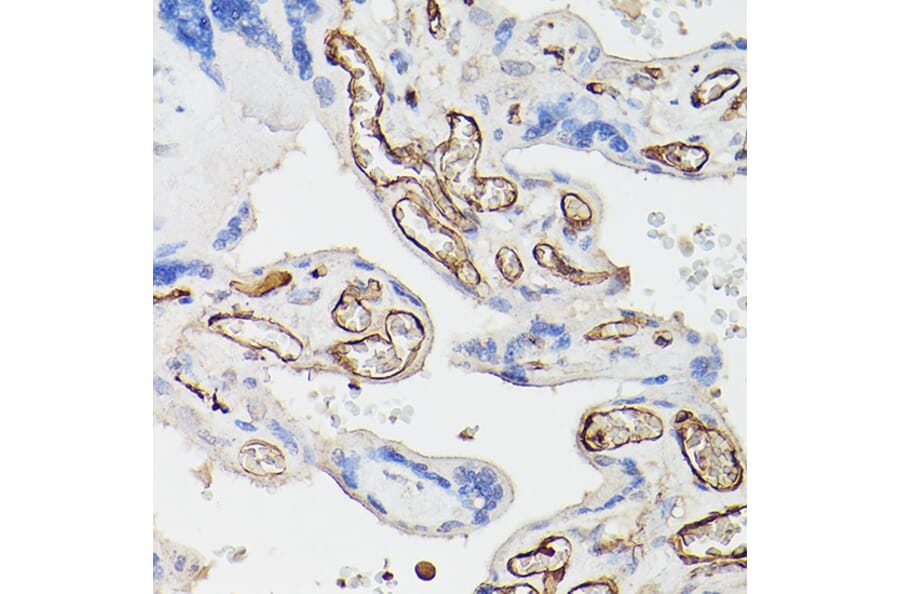 Immunohistochemistry - Anti-CD34 Antibody (A87833) - Antibodies.com