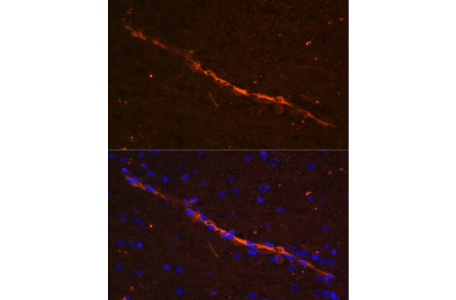 Immunofluorescence - Anti-CD34 Antibody (A87833) - Antibodies.com