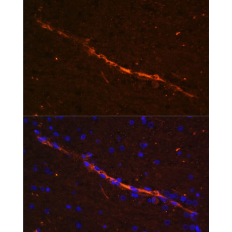 Immunofluorescence - Anti-CD34 Antibody (A87833) - Antibodies.com