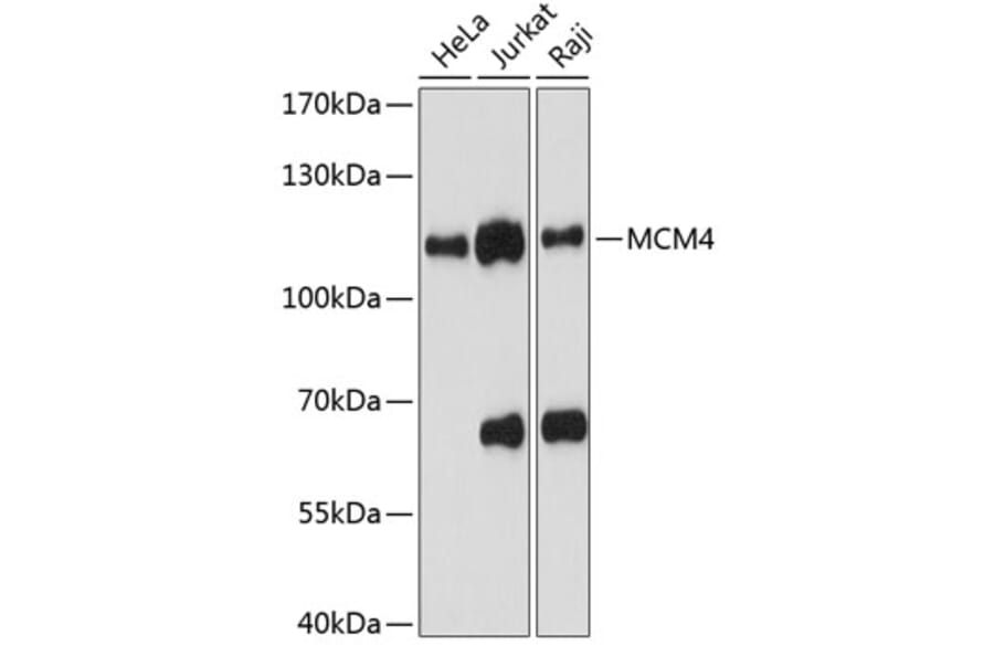 Western Blot - Anti-MCM4 Antibody (A87834) - Antibodies.com